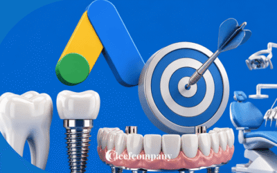 Anuncios implantes dentales para captar más pacientes